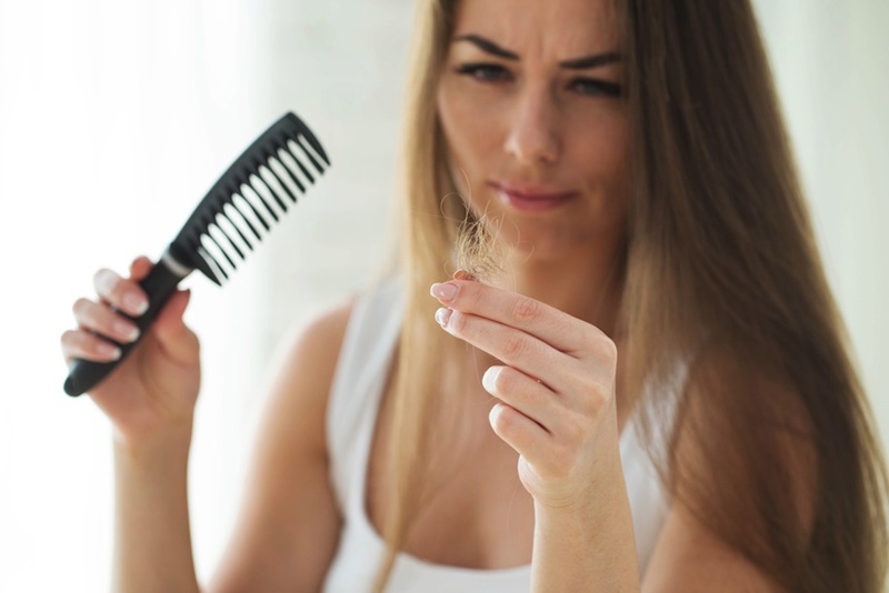 Calvície feminina: Motivos que podem levar à queda anormal de cabelos nas mulheres